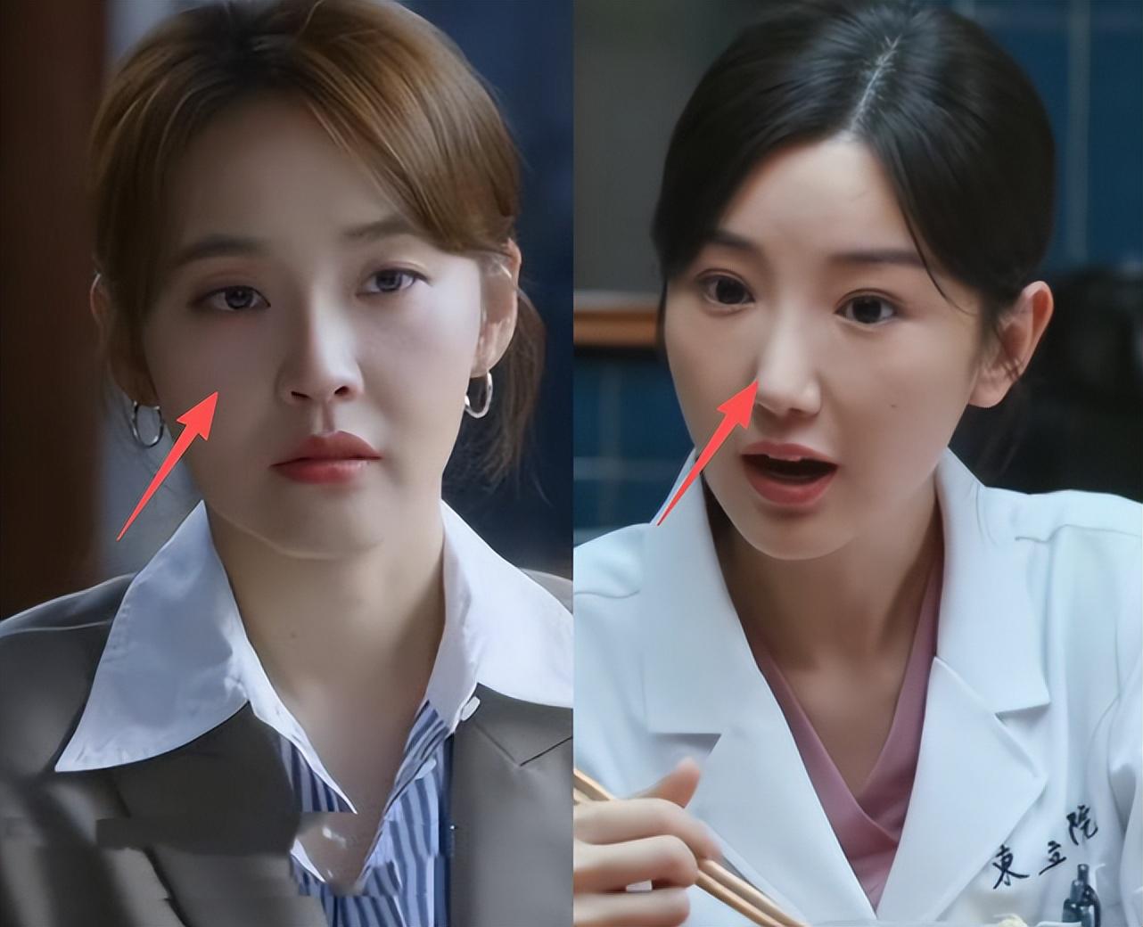 女演员千万别整容，看《问心2》毛晓彤与张佳宁同框，对比很惨烈